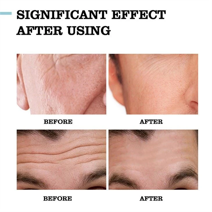 Men Collagen Retinol Anti Wrinkle Face Cream